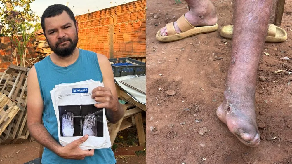 Adriano faz um apelo para que alguém se compadeça de sua situação e o ajude a encontrar um caminho para a cura e o alívio das dores que o têm torturado por tantos anos. (Foto: Eliton Chaves / 24H News MS)