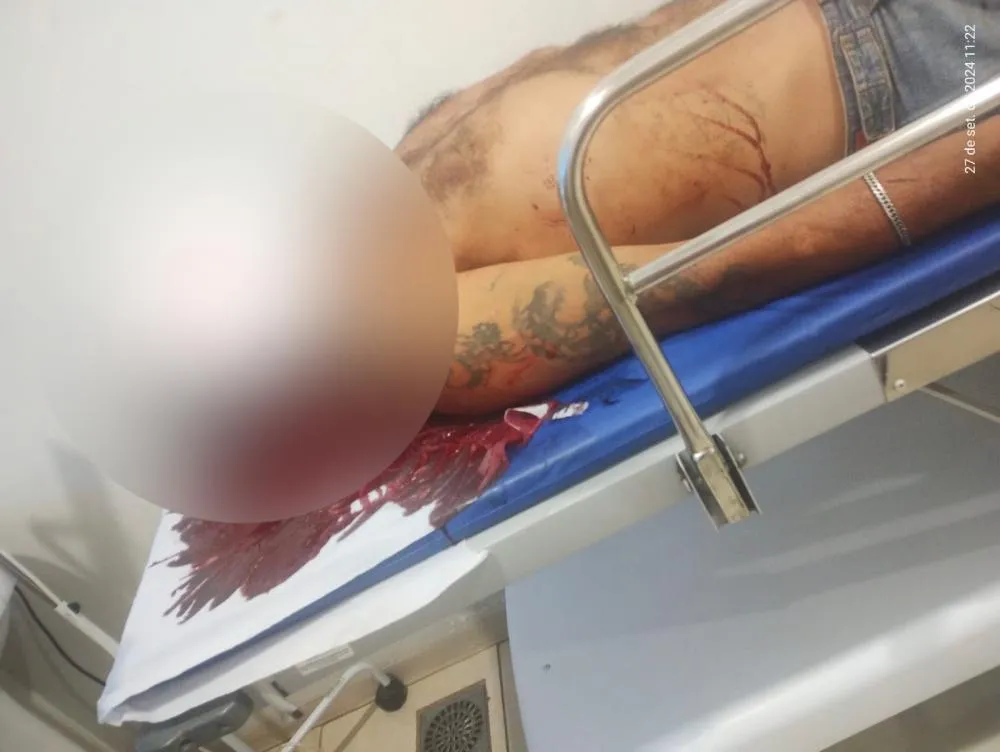 Equipe da Rádio Patrulha atendeu a ocorrência de agressão no Jardim Violetas, onde um homem foi atingido com um tijolo. (Imagem: Divulgação)