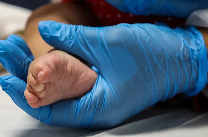Com exame simples e feito entre o 3º e o 5º dia de vida do bebê, Estado se antecipa ao cronograma nacional e oferece triagem ampliada como parte do Projeto Bem Nascer MS. (Foto: Agência Brasil)