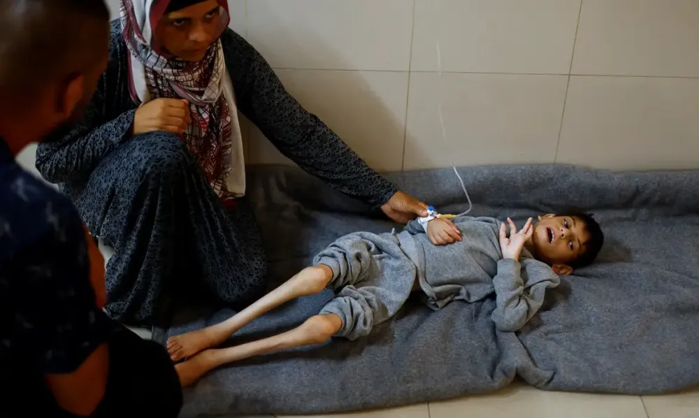 Unicef alerta para desnutrição aguda e colapso humanitário entre crianças em Gaza (Foto - Agência Brasil)