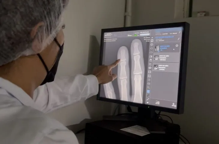 Raio-x digital e ultrassom já estão em funcionamento no Hospital da Sias (Foto - Divulgação Hospital Sias)