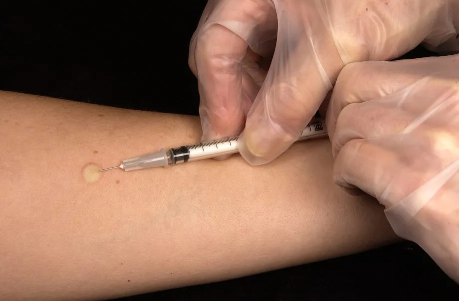 Prova Tuberculínica (PPD) passa a ser aplicada em novo endereço em Três Lagoas (Foto - Prefeitura de Três Lagoas)